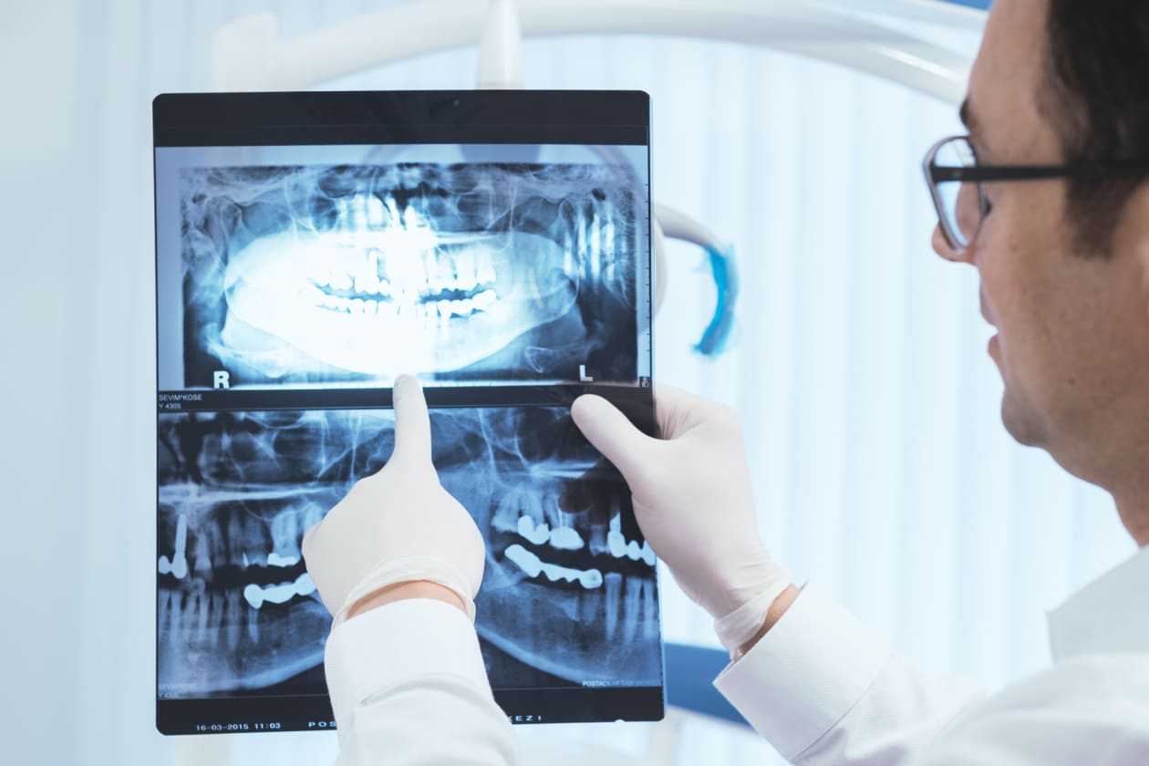 Opinion: Eyes, ears, teeth: Big changes coming — maybe — to Medicare ...