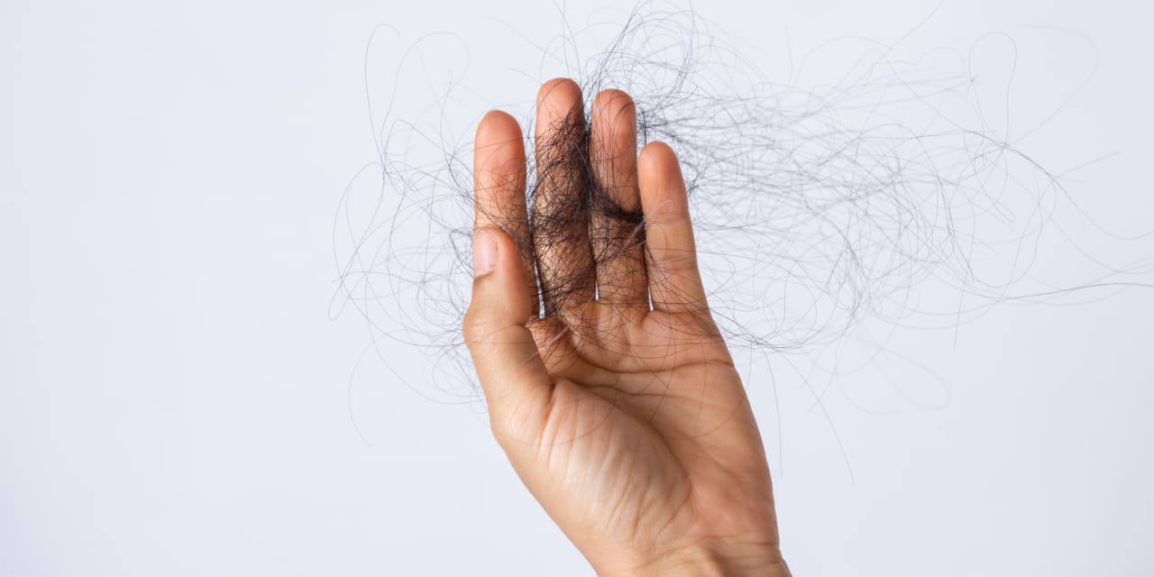 Hair loss is another symptom of long COVID. Here’s what experts say.
