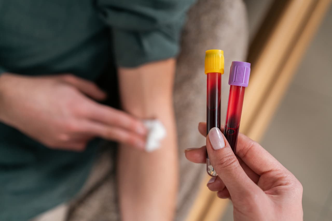 Is there a blood test for Alzheimer’s? Yes, but it isn’t at your doctor’s office yet.