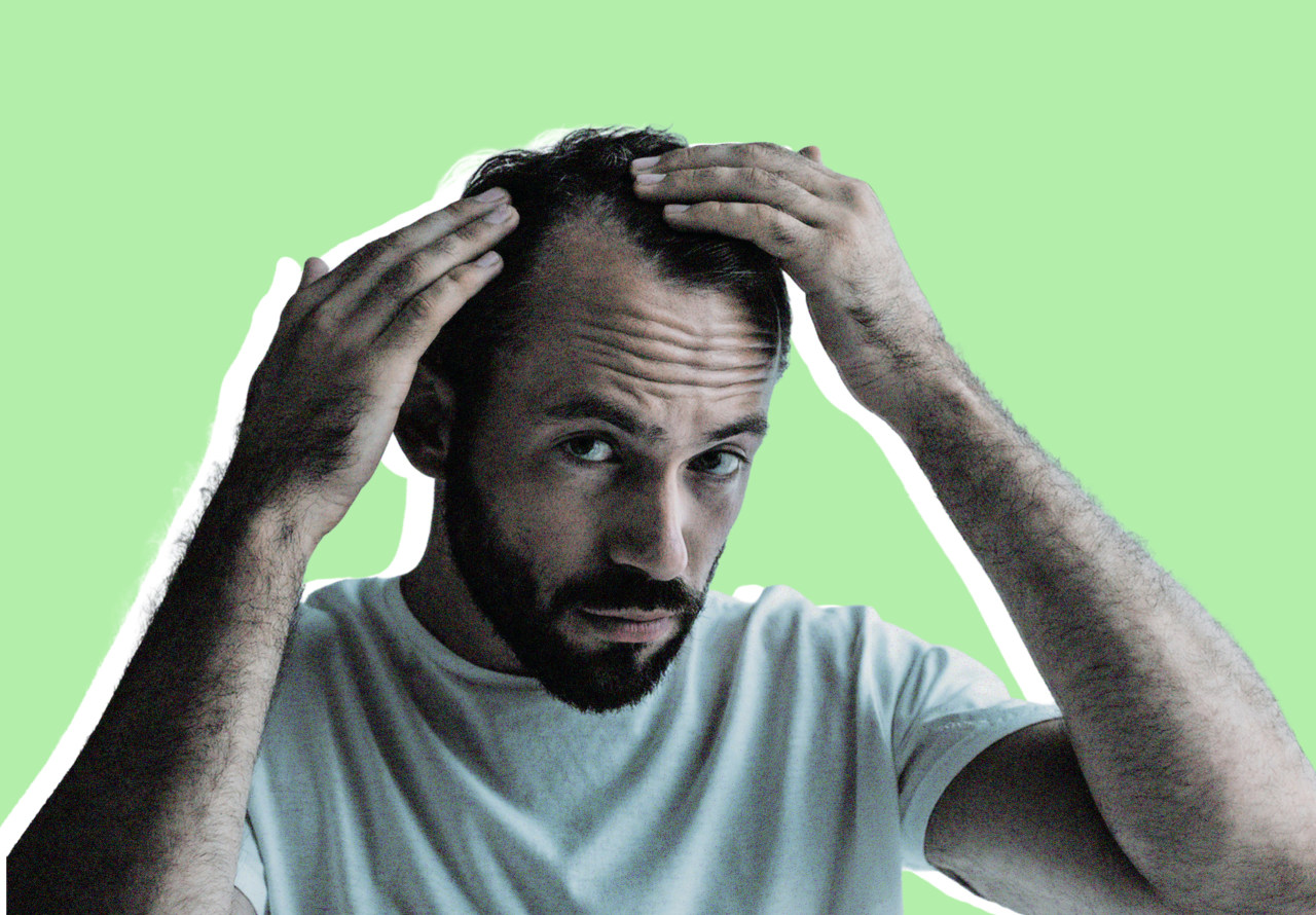 A new version of an old drug is helping men grow back some of their hair