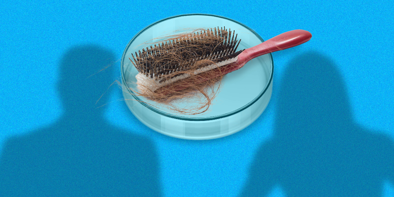 For the first time in decades, new hair-loss treatments are in the works ...